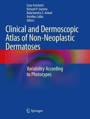 Buy Clinical and Dermoscopic Atlas of Non-Neoplastic Dermatoses by Enzo ...