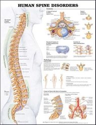  Understanding Low Back Pain Anatomical Chart : Lippincott  Williams & Wilkins: Industrial & Scientific