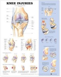 https://wordery.com/jackets/48905523/knee-injuries-anatomical-chart-anatomical-chart-company-9781587797569.jpg?width=196&height=250