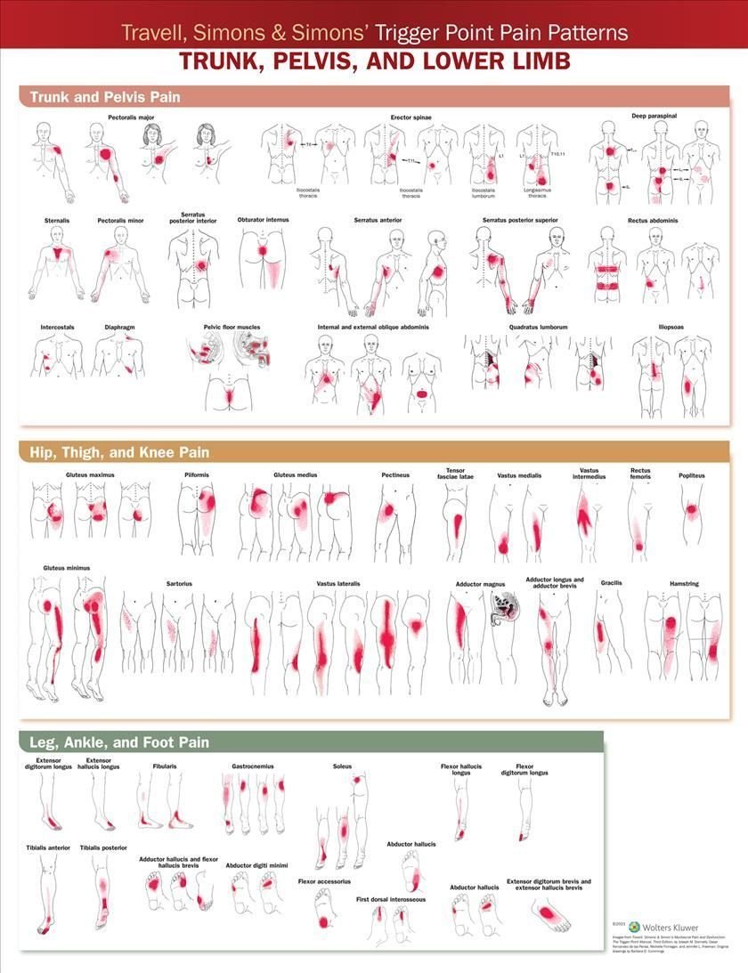 Buy Travell, Simons & Simons' Trigger Point Pain Patterns Wall Chart by ...