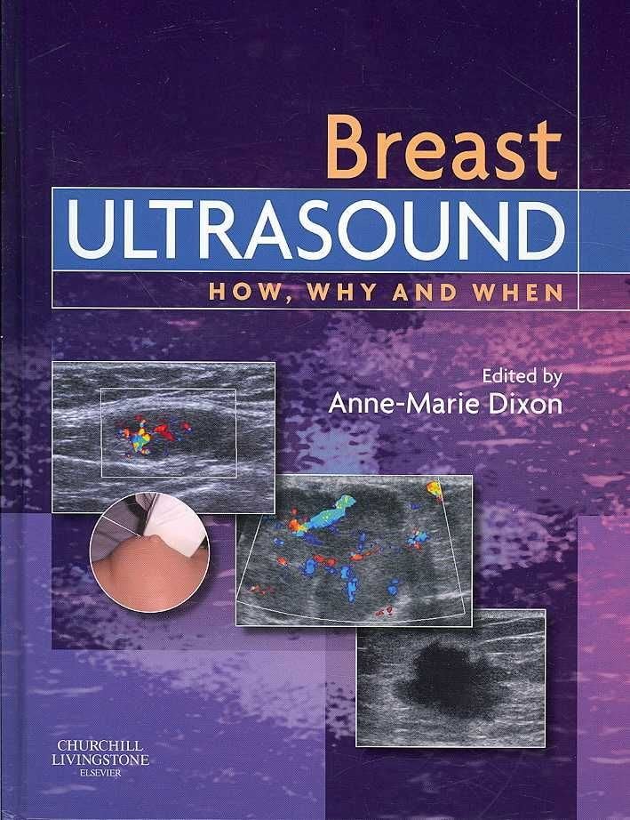 Anne-Marie　Dixon　With　Free　Ultrasound　Buy　by　Breast　Delivery