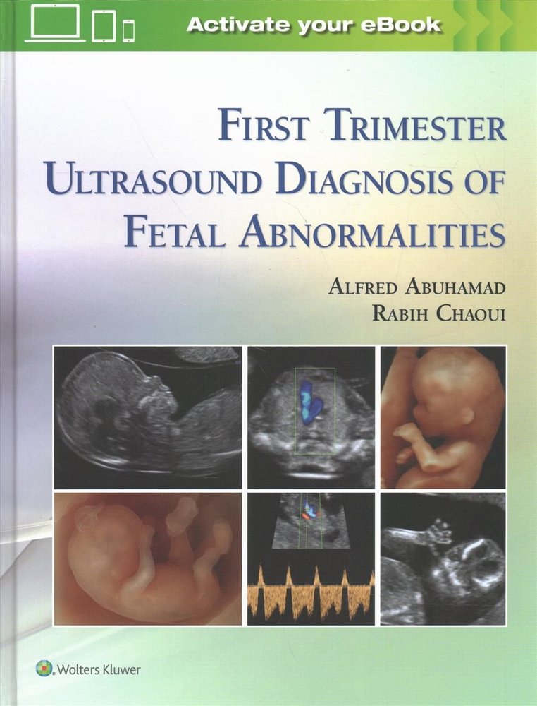 First Trimester Ultrasound Diagnosis Of Fetal Abnormalities Pdf