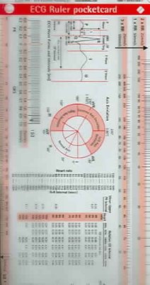 EKG Ruler & Diagram Reference Card