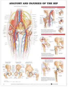 Anatomy and Injuries of the Hip Anatomical Chart by Anatomical Chart  Company (Wallchart)