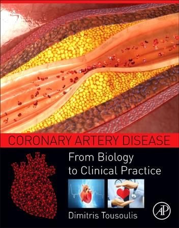 Coronary Artery Disease | US